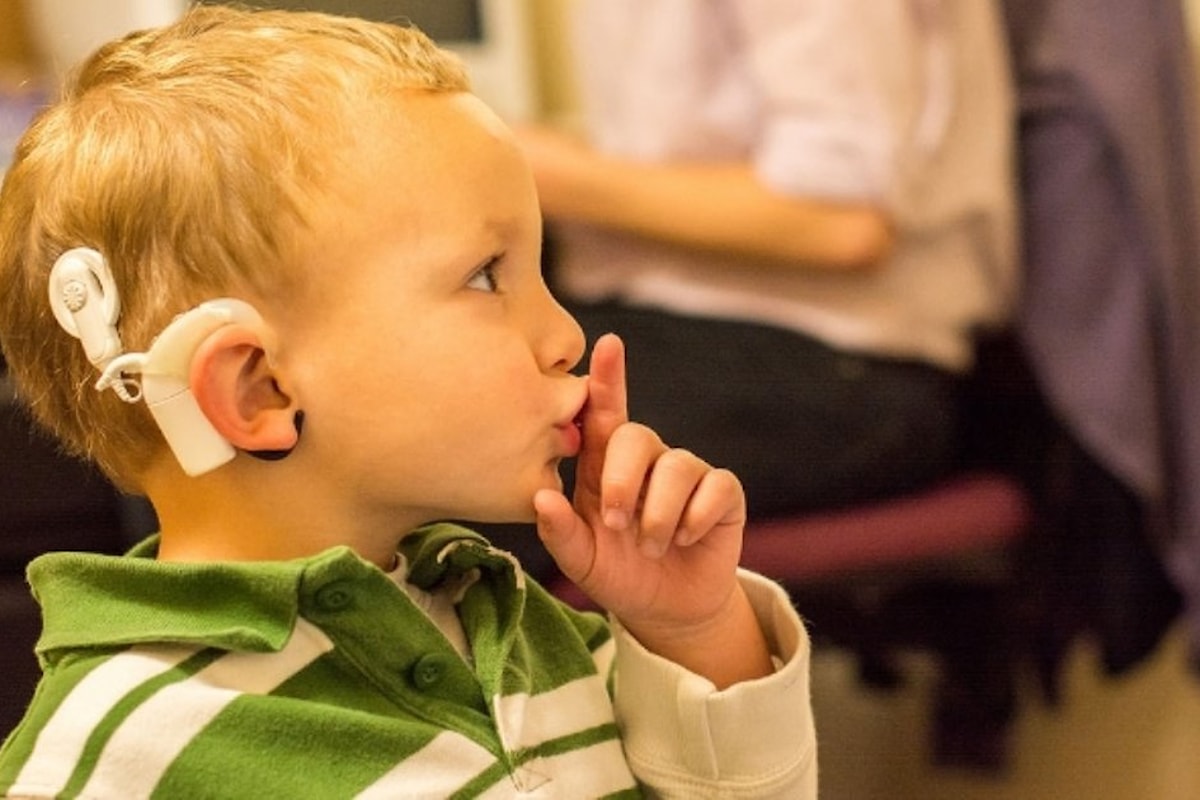 Слышащие дети в семье глухих. Аппарат для глухих кохлеарная имплантация. Кохлеарная имплантация Cochlear. Слабослышащие дошкольники. Глухие и слабослышащие дети.
